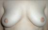 nipps