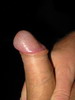 1 1