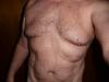 naked body