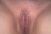 besamte Muschi01